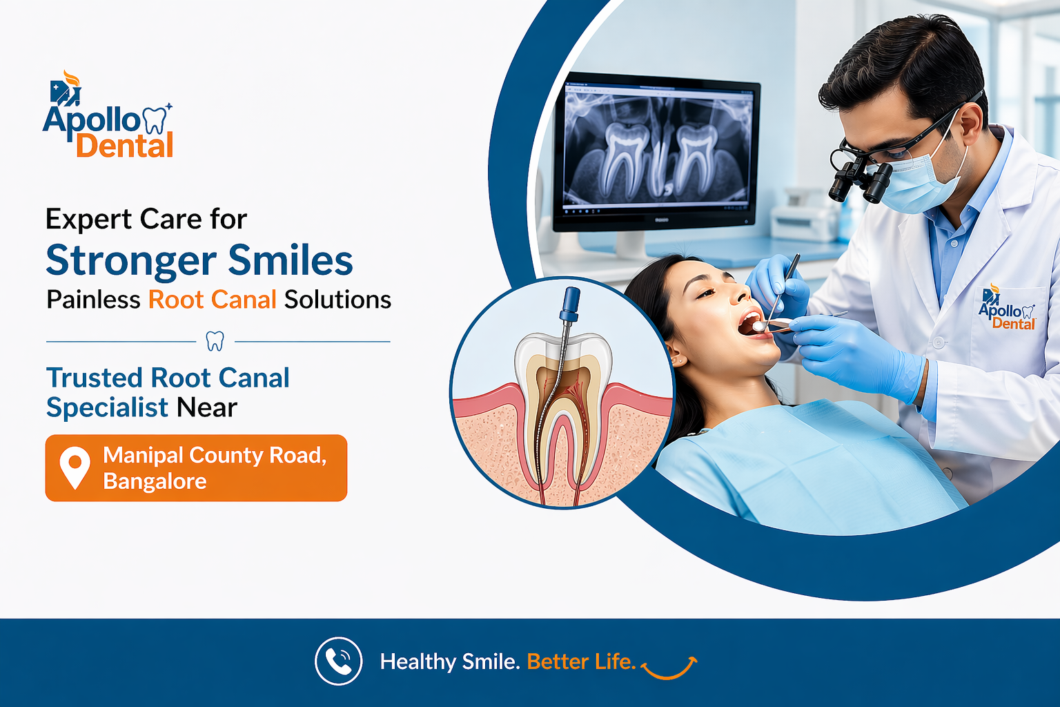 Best Root Canal Specialist Near Manipal County Road